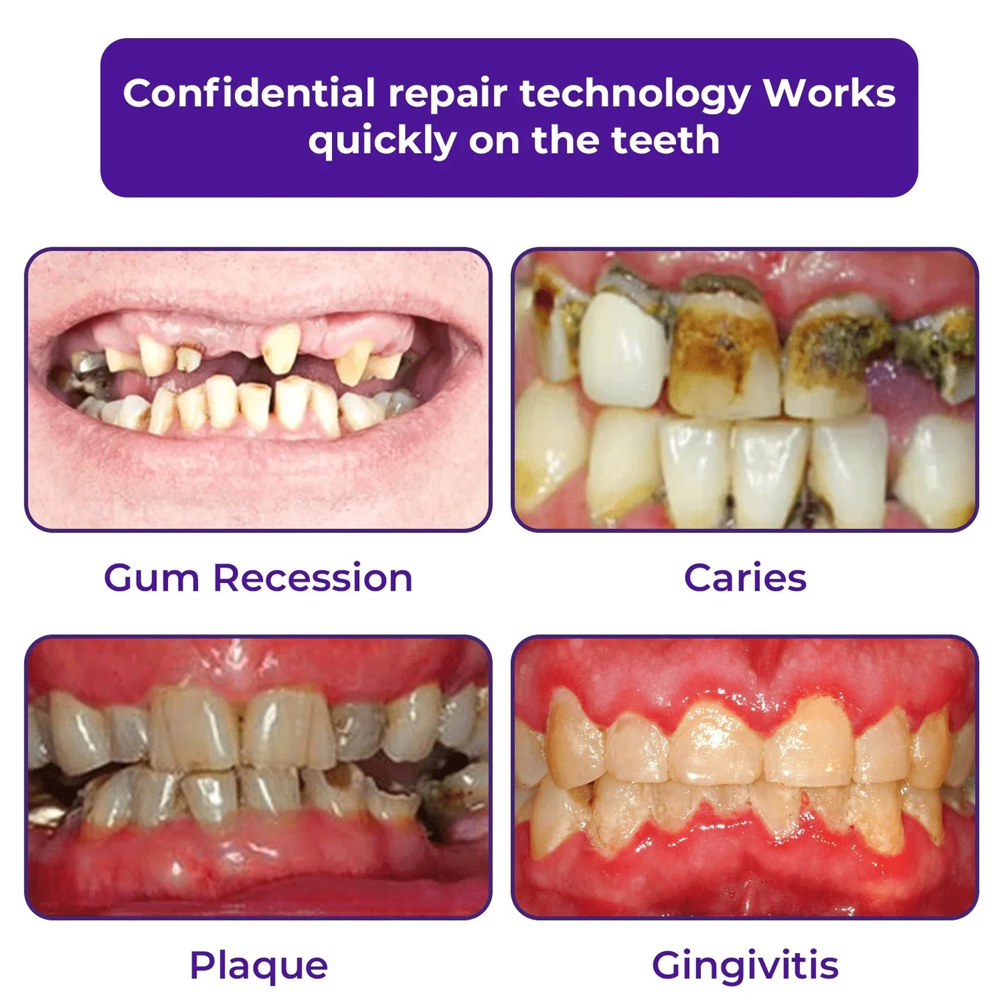 Cvreoz® Teeth Restoration Mineral Powder 🦷✨ Treats periodontitis & mouth ulcers, whitens teeth, prevents tooth loss, and repairs gum recession 😁