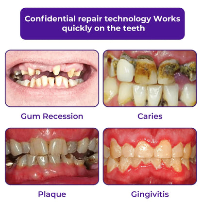 Cvreoz® Teeth Restoration Mineral Powder 🦷✨ Treats periodontitis & mouth ulcers, whitens teeth, prevents tooth loss, and repairs gum recession 😁