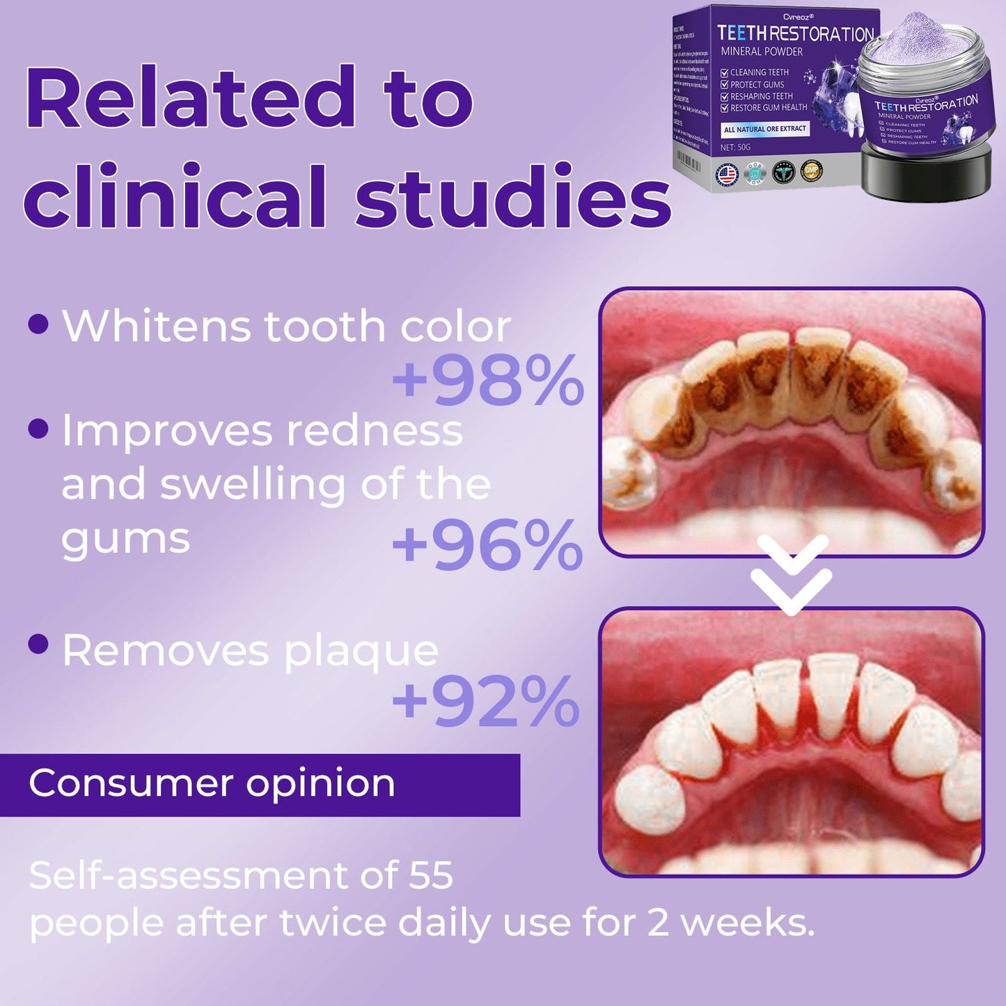 Cvreoz® Teeth Restoration Mineral Powder 🦷✨ Treats periodontitis & mouth ulcers, whitens teeth, prevents tooth loss, and repairs gum recession 😁